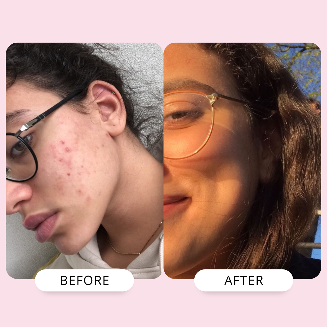 Hyperpigmentation Correction Duo